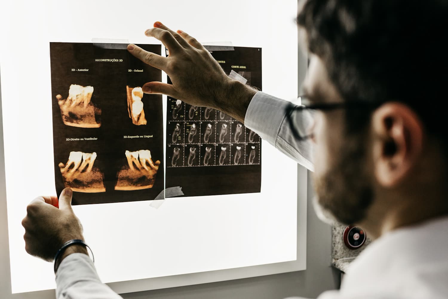 Odontólogo revisando radiografías a contraluz