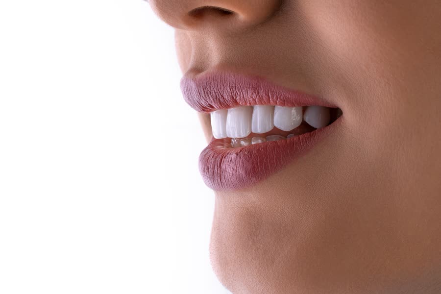 Sonrisa tras un tratamiento de estética dental